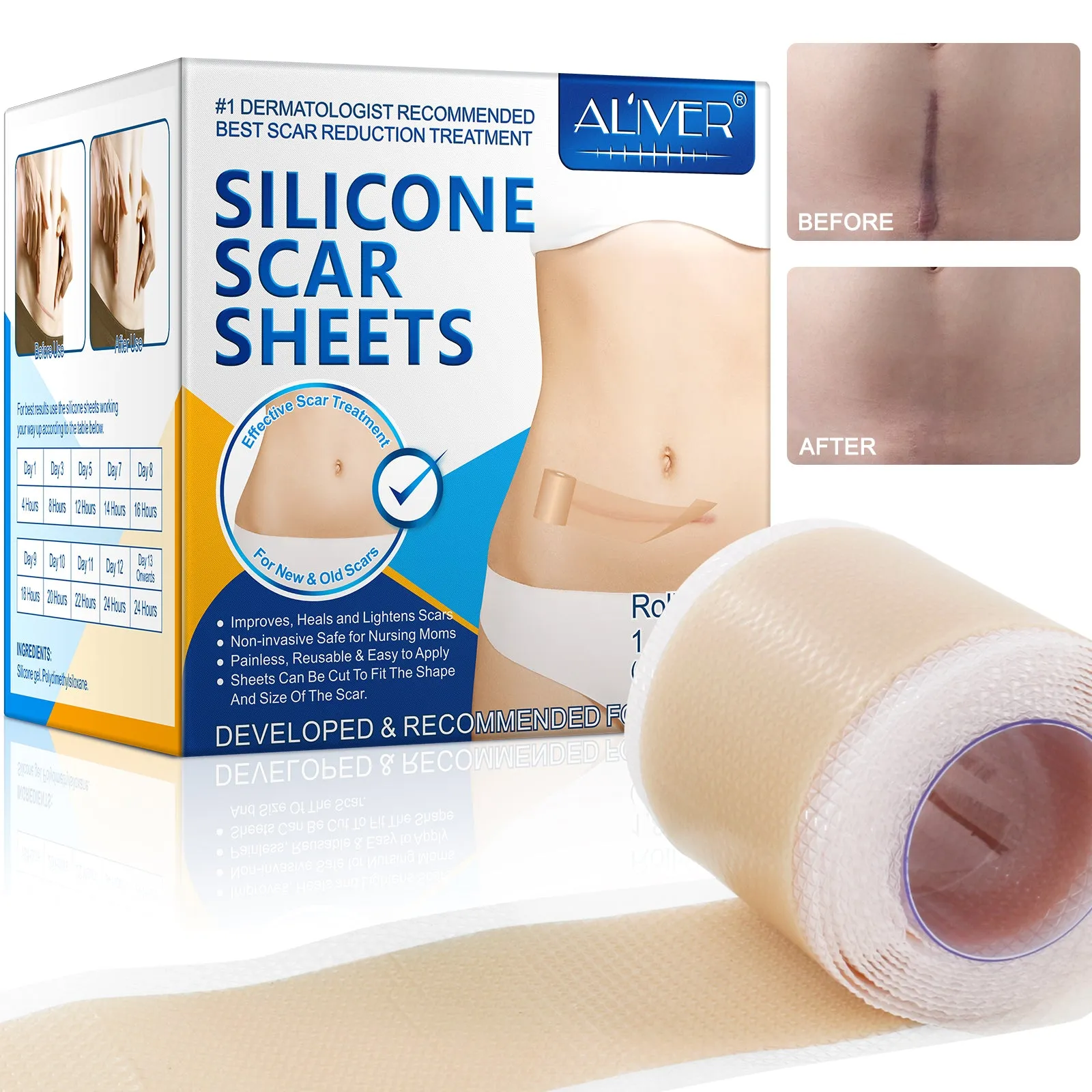 ALIVER Silicone Scar Sheets, Silicone Scar Tape-1.8”x120”, Scar Removal Strips for Acne Scars C-Section & Keloid Surgery Scars Sheets - 6-8 Month Supply
