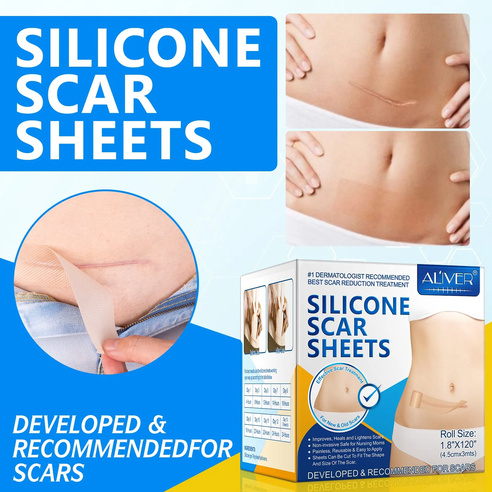 ALIVER Silicone Scar Sheets, Silicone Scar Tape-1.8”x120”, Scar Removal Strips for Acne Scars C-Section & Keloid Surgery Scars Sheets - 6-8 Month Supply