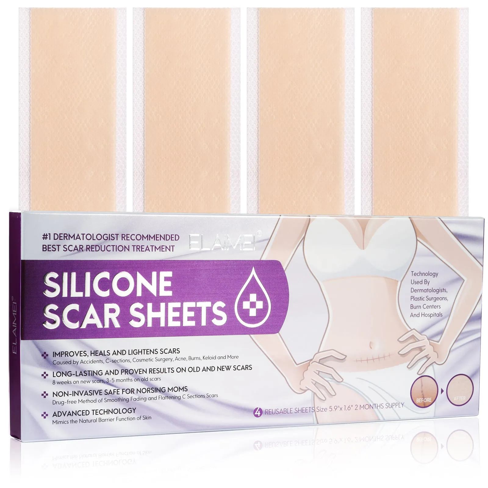 ELAIMEI Silicone Scar Sheets, Silicone Scar Tape, Scar Removal Strips for Acne Scars C-Section & Keloid Surgery Scars Sheets - 6-8 Month Supply