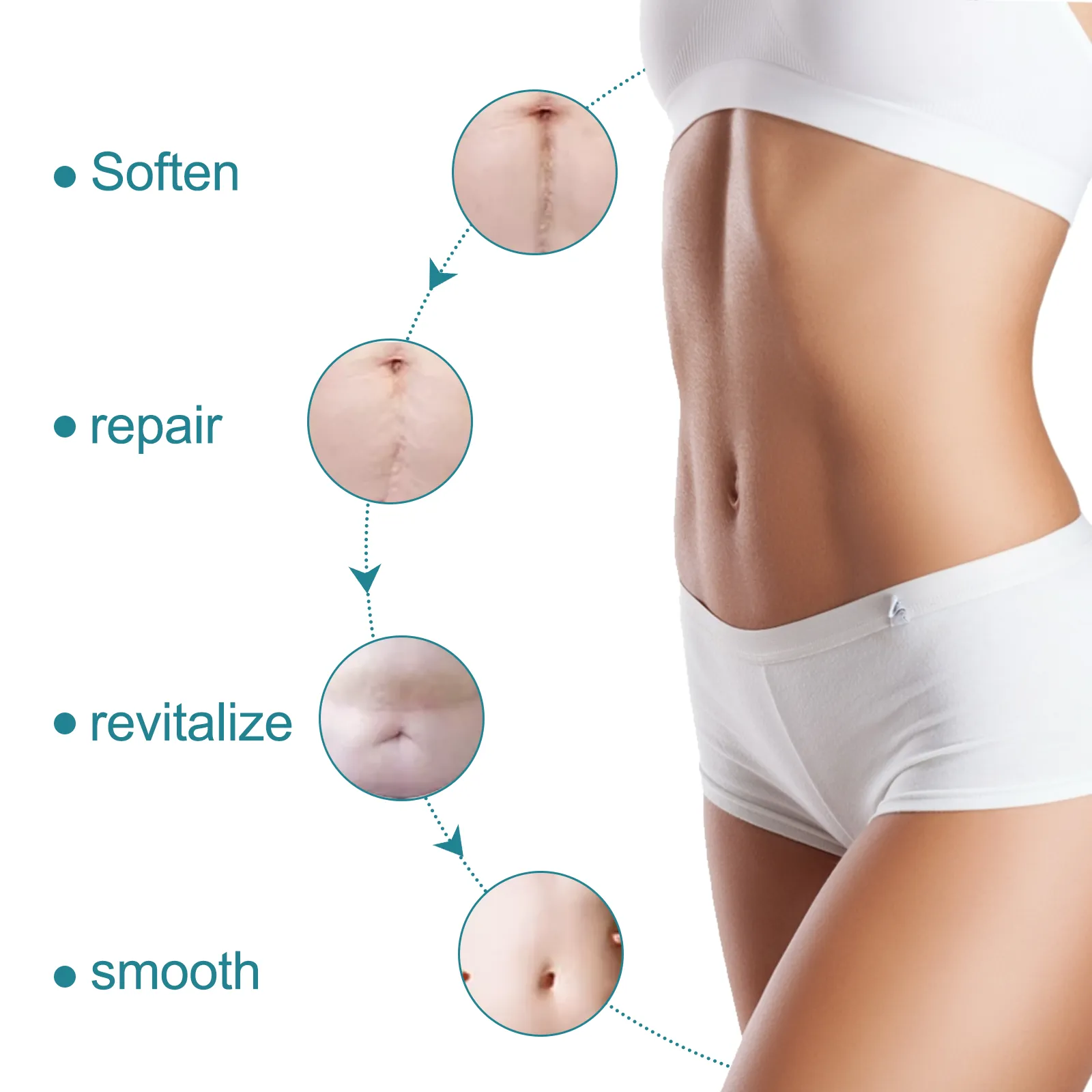ELAIMEI Silicone Scar Sheets, Silicone Scar Tape, Scar Removal Strips for Acne Scars C-Section & Keloid Surgery Scars Sheets - 6-8 Month Supply