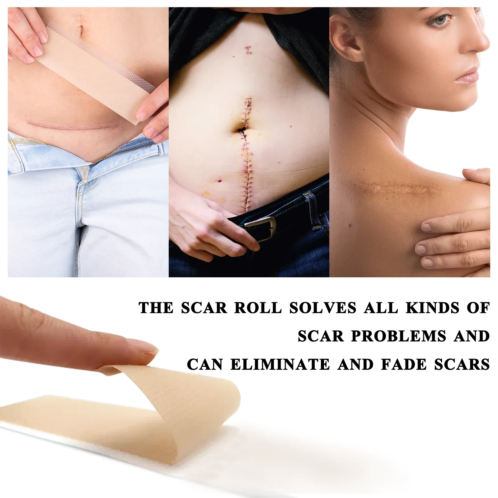 ELAIMEI Silicone Scar Sheets, Silicone Scar Tape, Scar Removal Strips for Acne Scars C-Section & Keloid Surgery Scars Sheets - 6-8 Month Supply