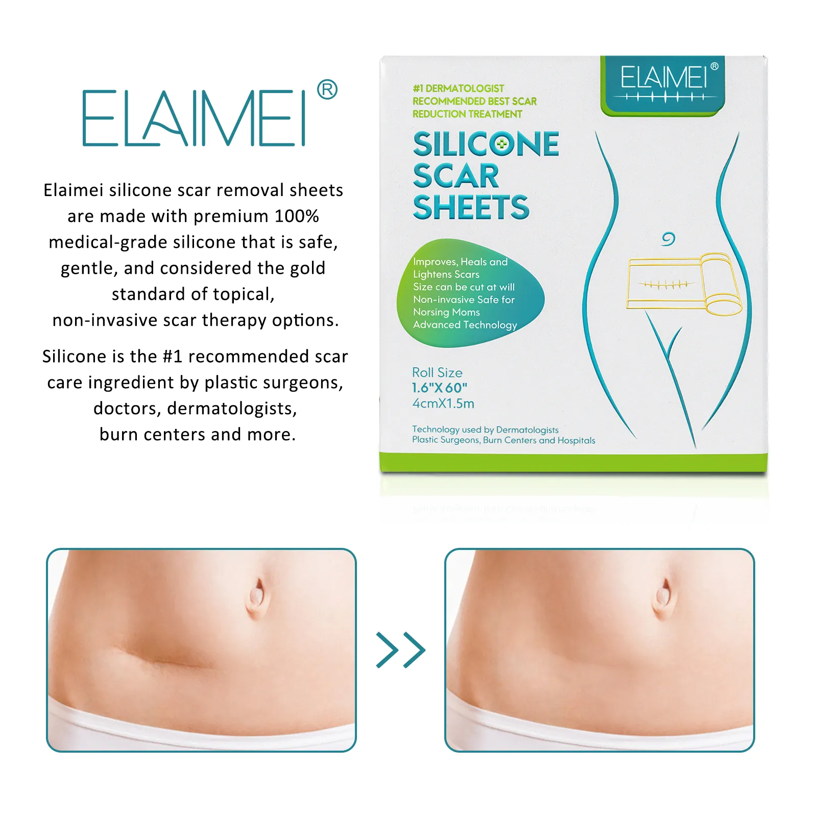 ELAIMEI Silicone Scar Sheets, Silicone Scar Tape, Scar Removal Strips for Acne Scars C-Section & Keloid Surgery Scars Sheets - 6-8 Month Supply