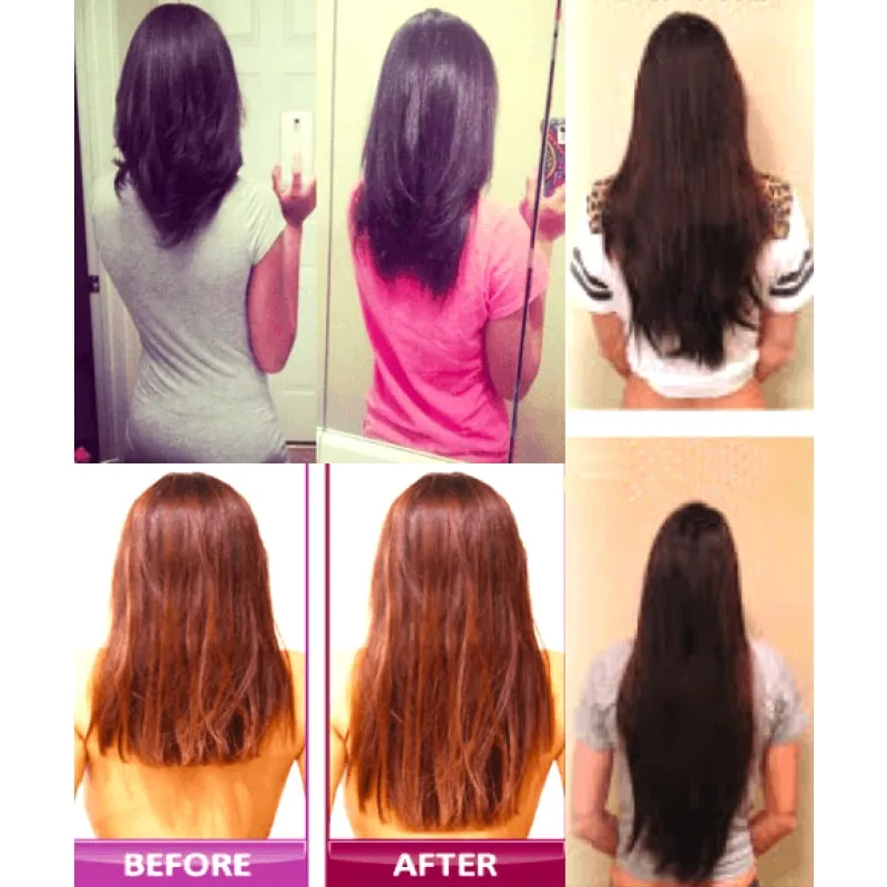 Home Medical Hair Growth Laser Device